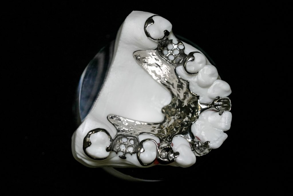 DSC00036 removable partial denture